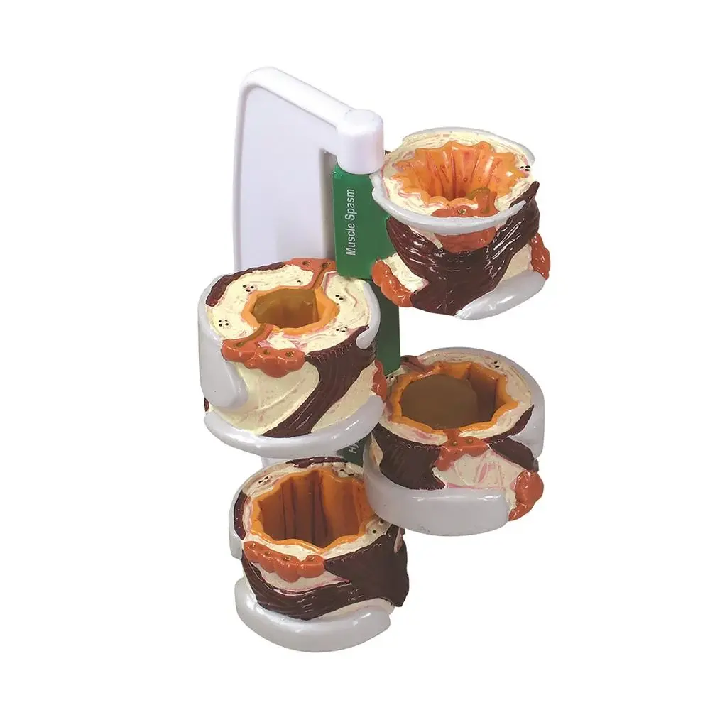 Asthma and Allergies Education