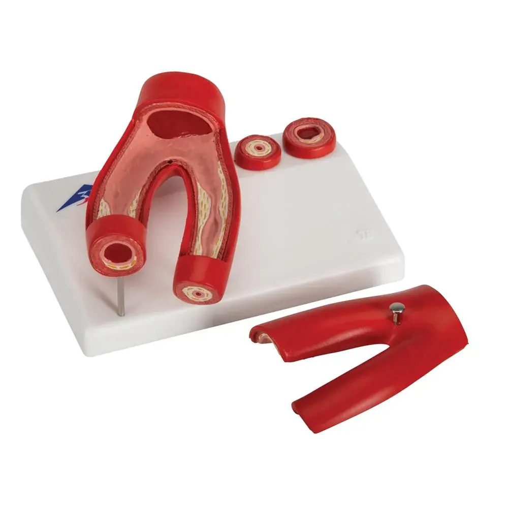 Heart Diseases Education