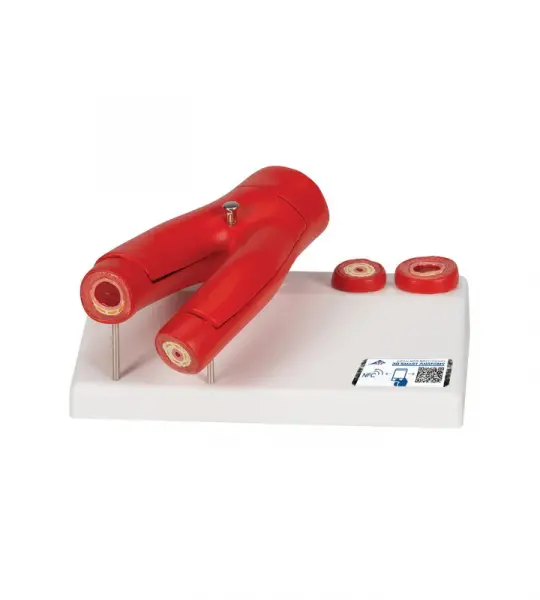 Arteriosclerosis Model, with cross section of artery, 2 part