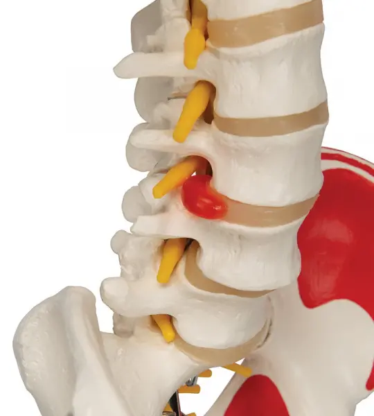 Sam Skeleton with Muscles and Ligaments on Pelvic Stand