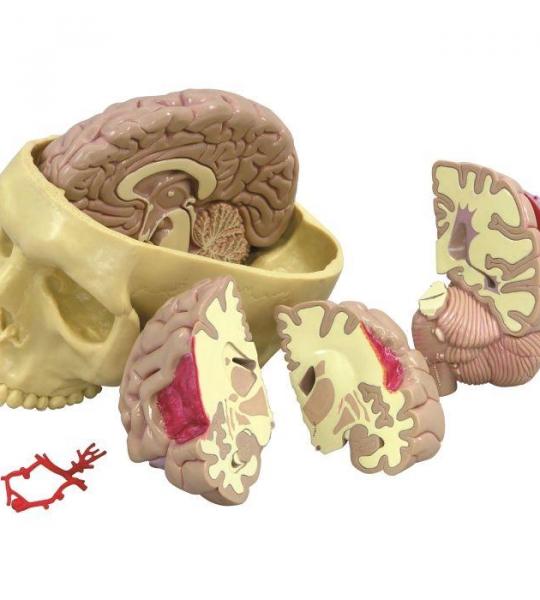 Brain Model and Partial Skull
