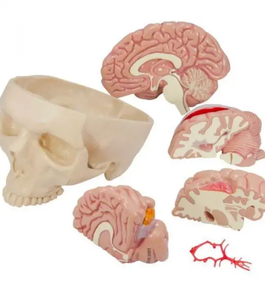 Brain Model and Partial Skull